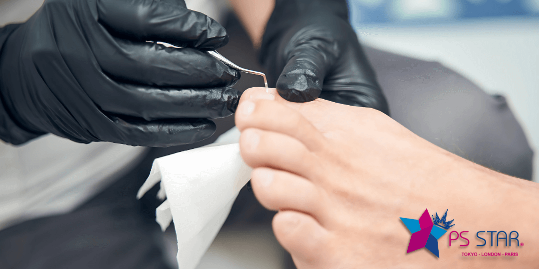 Pedicura, Prodologia, Uñas encarnadas, Pusher Cureta 331P